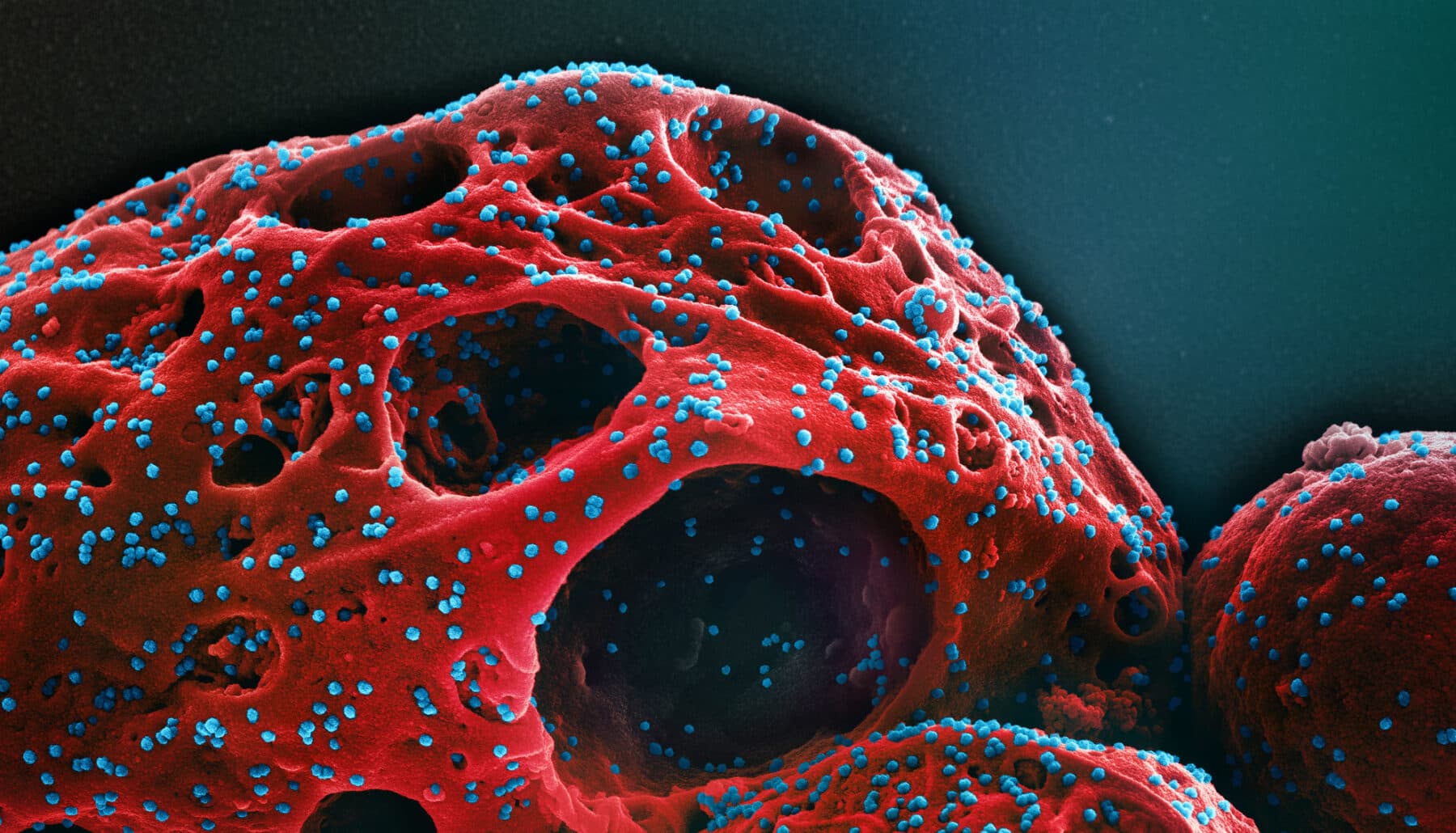 Micrographie électronique à balayage colorisée d'une cellule (rouge) infectée par la souche Omicron des particules du virus SARS-CoV-2 (bleu), isolée à partir d'un échantillon de patient.